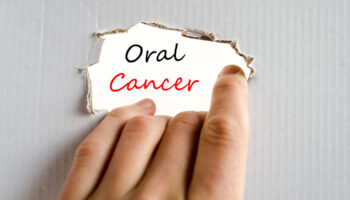 HPV and Oral Cancer: Exploring the Link and Staying Informed