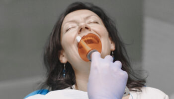 Oral Surgery for Impacted Teeth: What You Need to Know