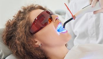 How Do Professional In-Office Whitening Treatments Compare to Home Kits?