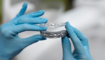 How Long Does Invisalign Take? Your Full Timeline